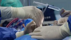 Crisis por descertificación del centro de trasplantes en la Universidad de Miami refleja retos del sistema de salud en Florida